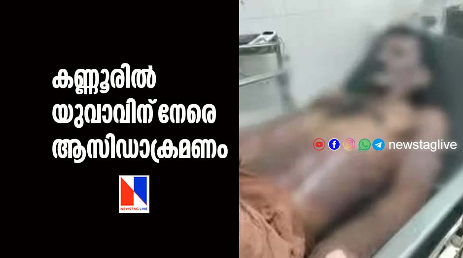 acid attack against man in kannur