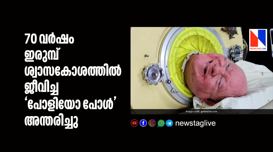 polio paul dies who lived 70 years in iron lung