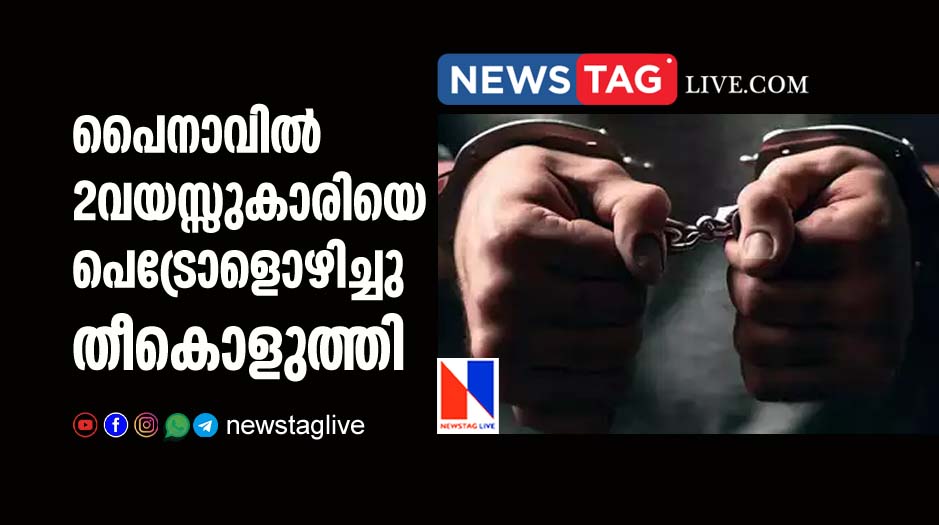 2 year old girl set ablaze by relative in Painavu
