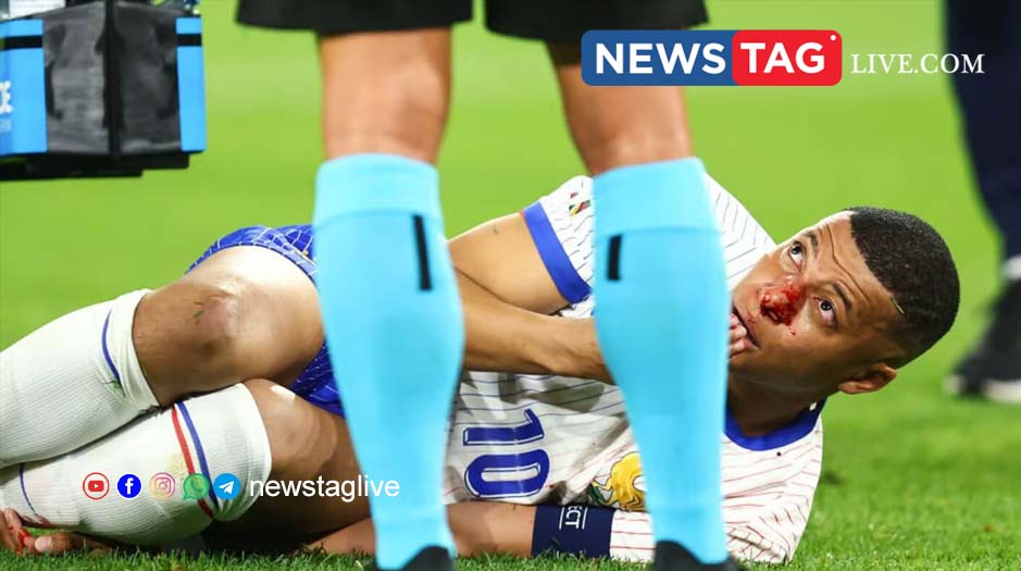 Kylian Mbappe nose injury