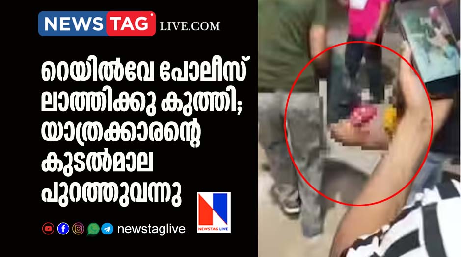 Man s intestines bulge out as Railway cop beat up with baton