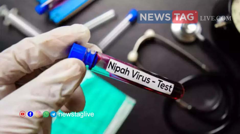 Nipah Virus Test