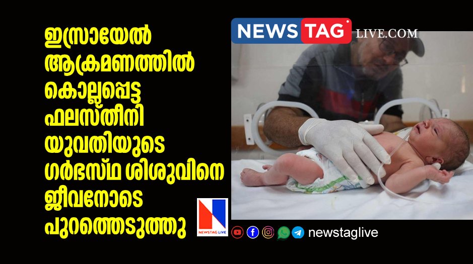 doctors saved dead palestine womans baby from womb