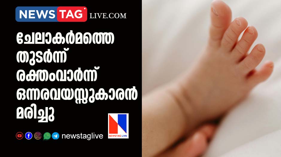 18 month old boy dies due to heavy bleeding after circumcision