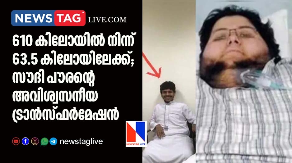 incredible transformation by saudi man by reducing 542 kg body weight