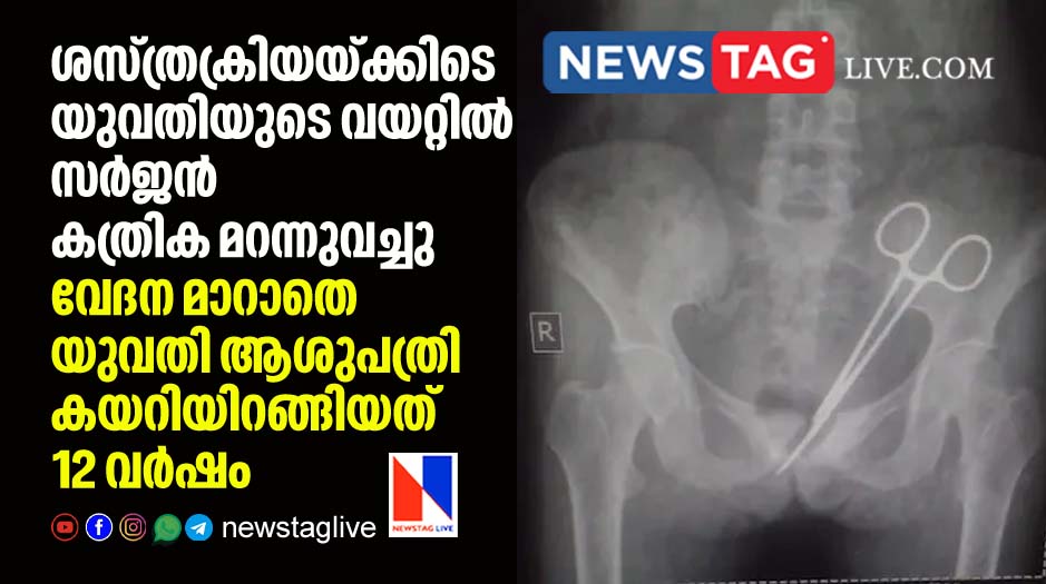 Doctors Leave Pair Of Scissors In Woman s Abdomen Found only after12 Years