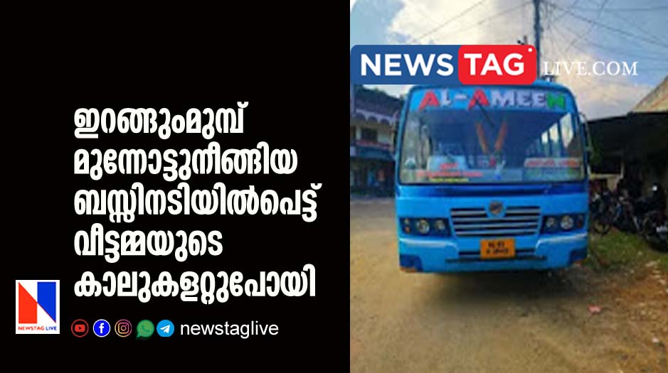 woman lost her legs after falls from private bus