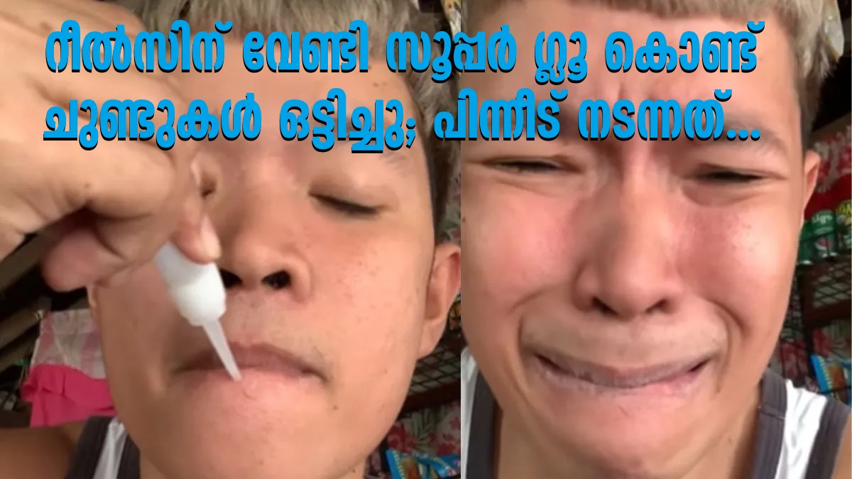 Man's Superglue Prank