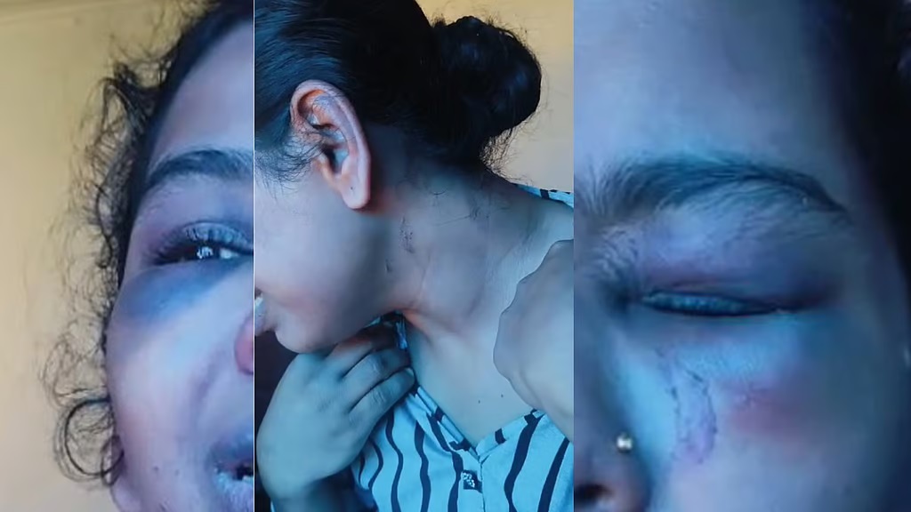 Woman locked in house, tied a belt around her neck and brutally beaten