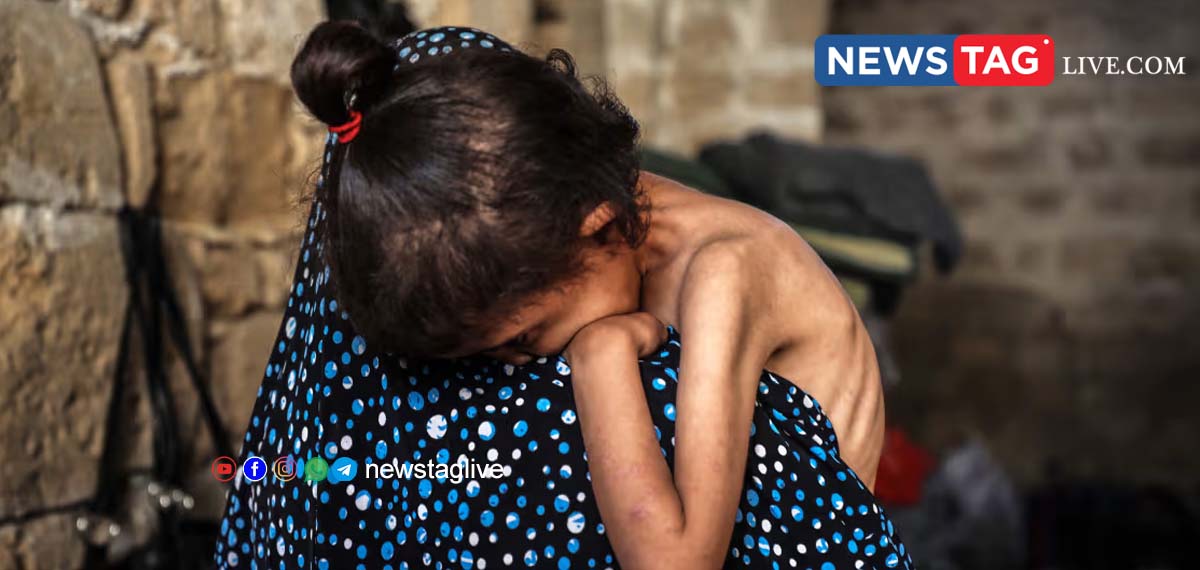 gaza starving