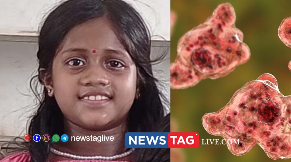 Amoebic Meningoencephalitis confirmed for deceased girls brother