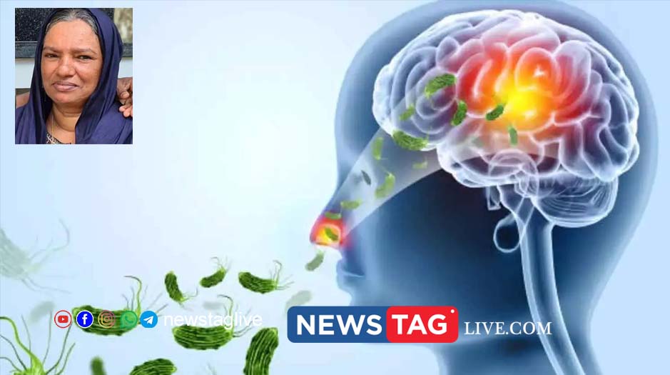 Amoebic encephalitis