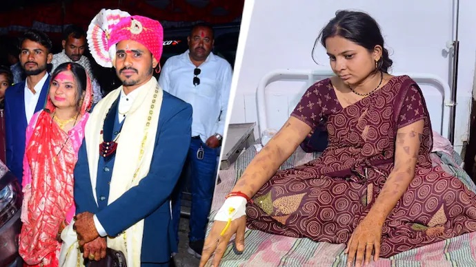 Madhya Pradesh man ties up wife, puts hot knife in her mouth over dowry demands