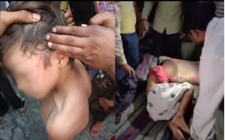 Class-1 Muslim Boy in Haridwar Beaten by Principal, Teacher for Missing a Day; Hand Fractured