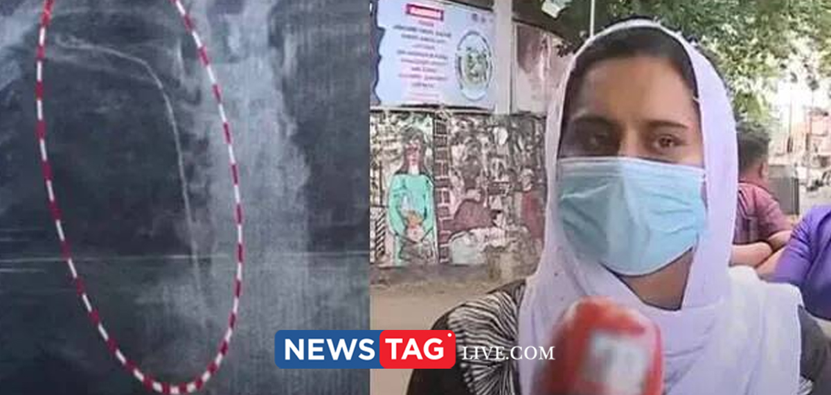 unable to remove guide wire from Sumayya's body even after key hole suregery