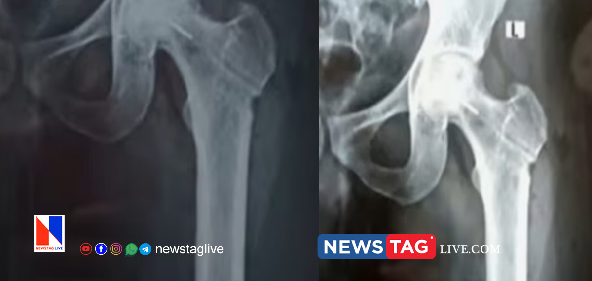 medical error complaint against Jubilee memorial hospital