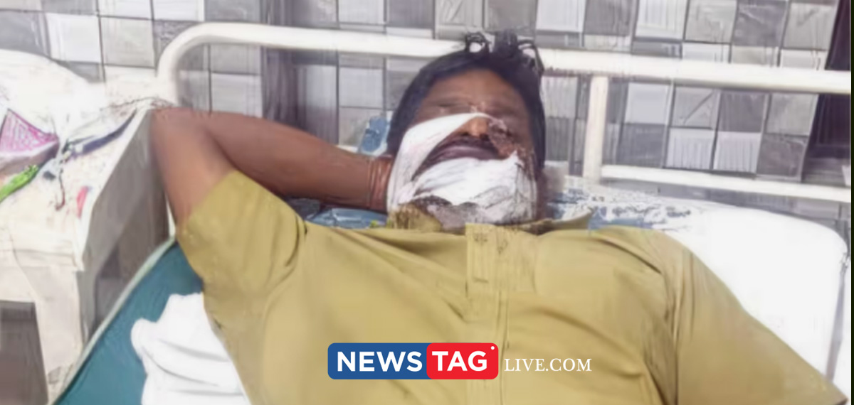 Stray dog bites lorry driver in Eroor