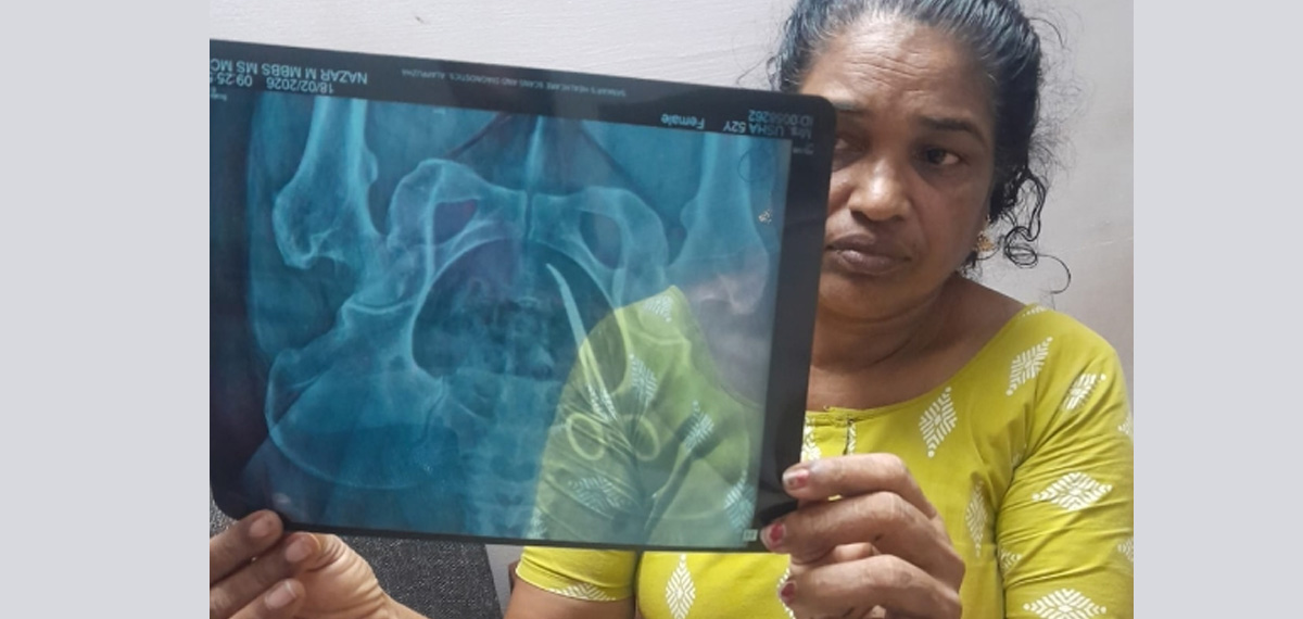 scissors found from woman s belly who under went surgery in Vandanam Med College