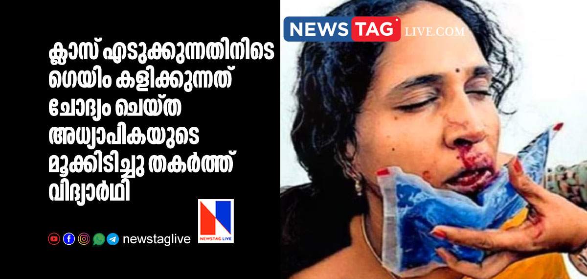 student punched on teachers nose after she opposed him to play game in room