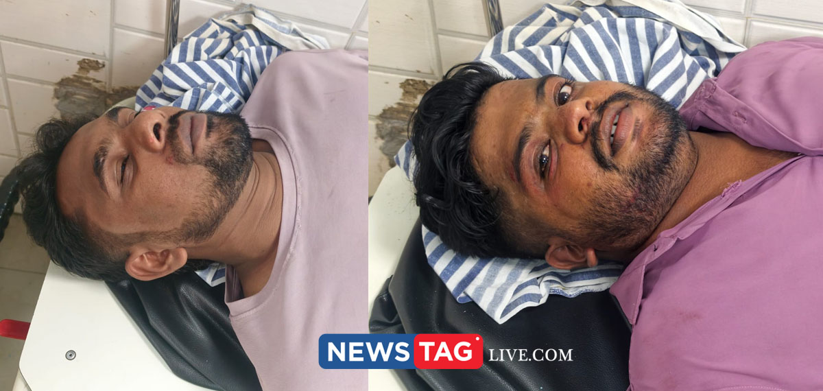 SDPI workers attacked by Congress criminals in Balaramapuram