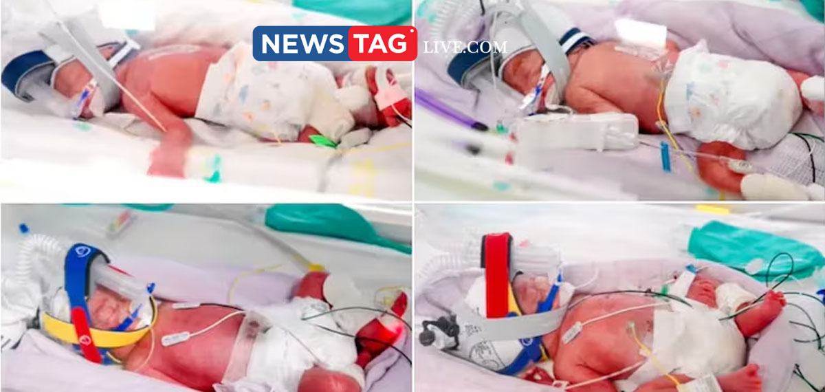 mother of quadruplet seeks financial aid to buy 10 seater van
